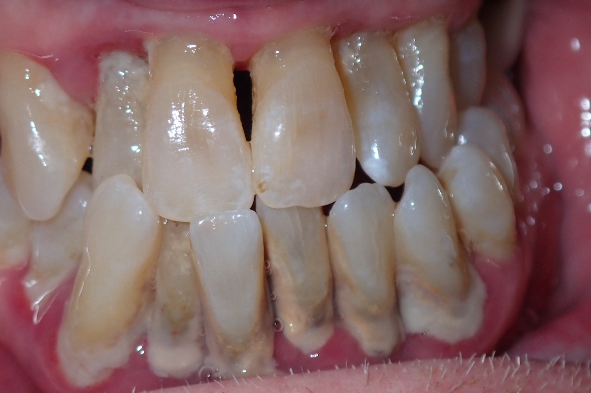 smile gallery image