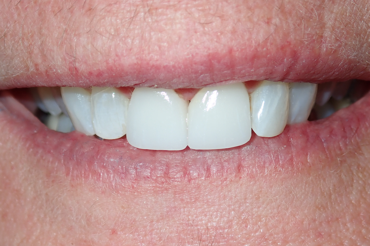 smile gallery image