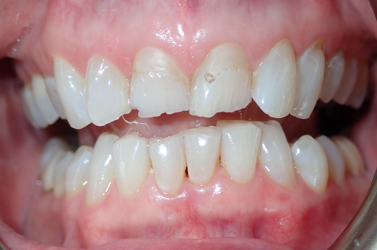 smile gallery image