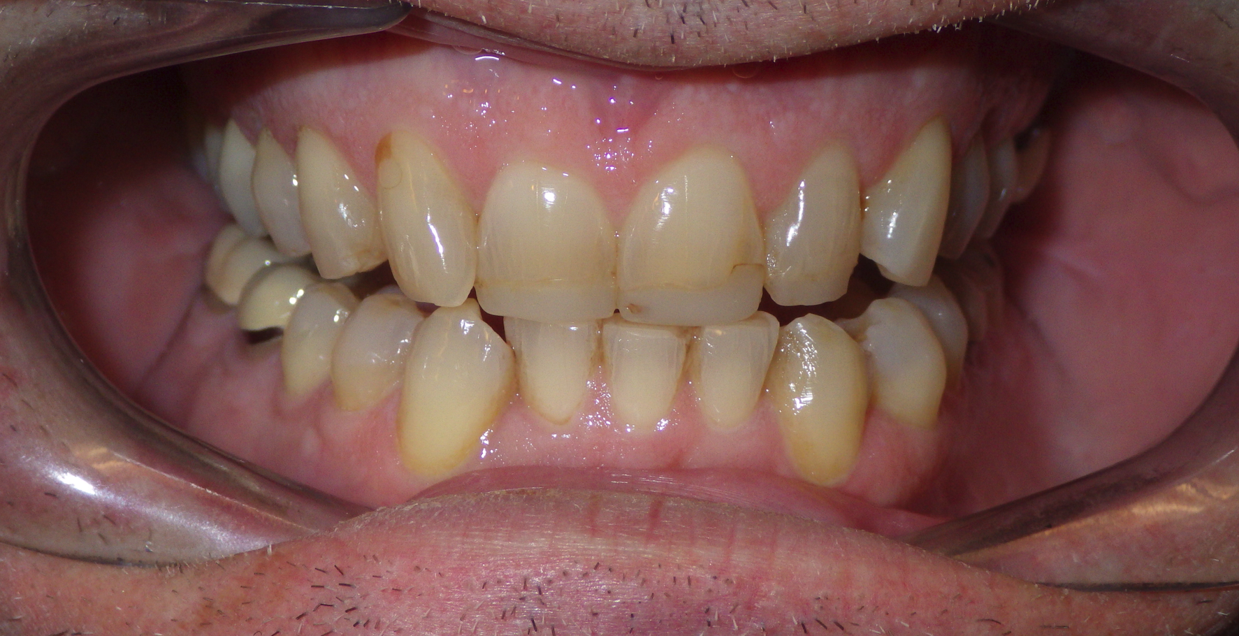 smile gallery image