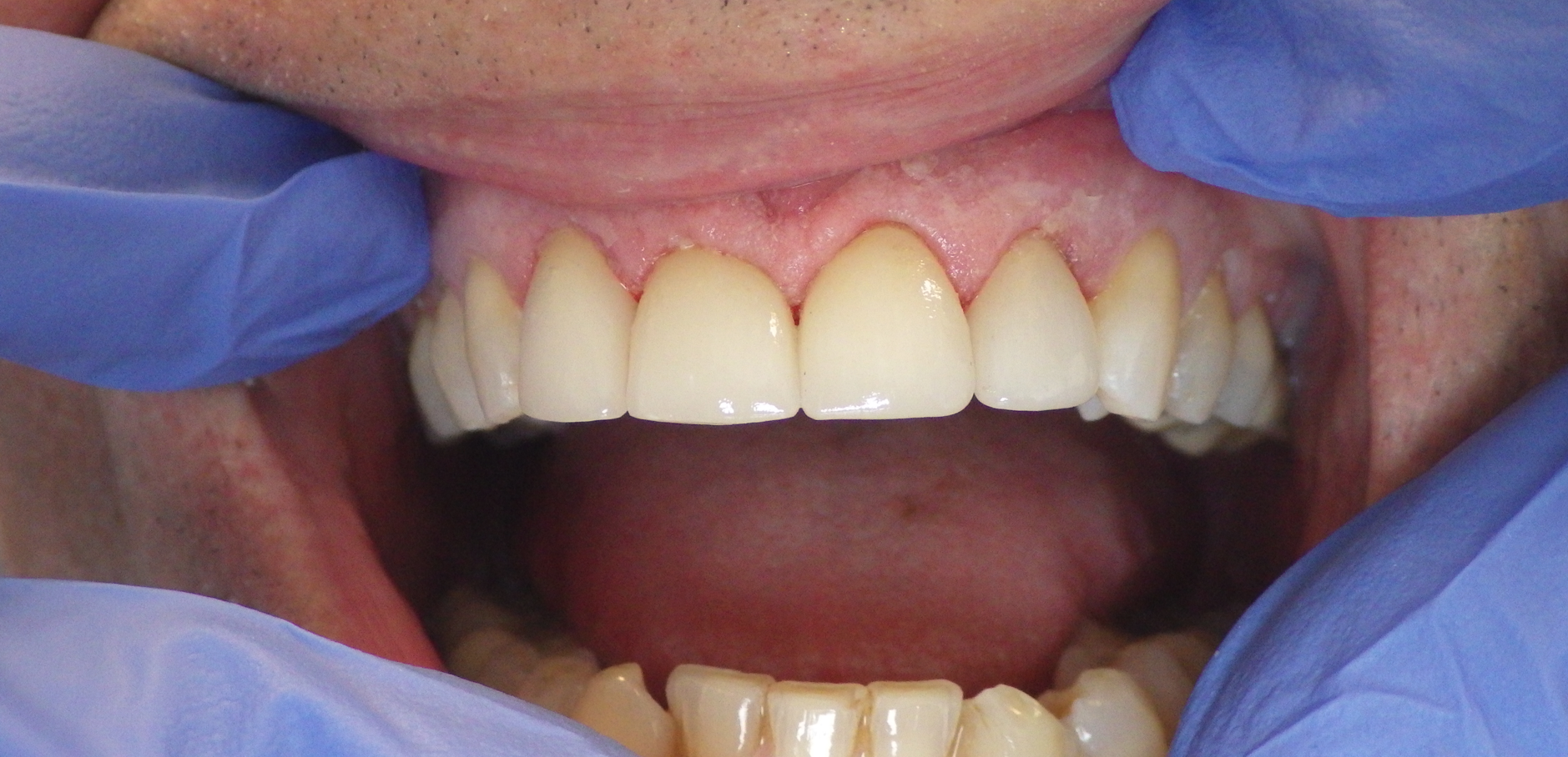 smile gallery image