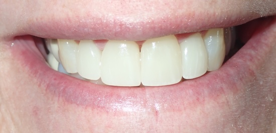 smile gallery image