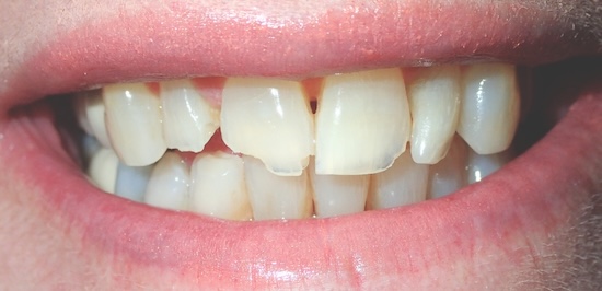 smile gallery image