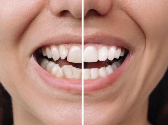 Cosmetic Dentistry: Creating a Smile You’ll Feel Confident Sharing