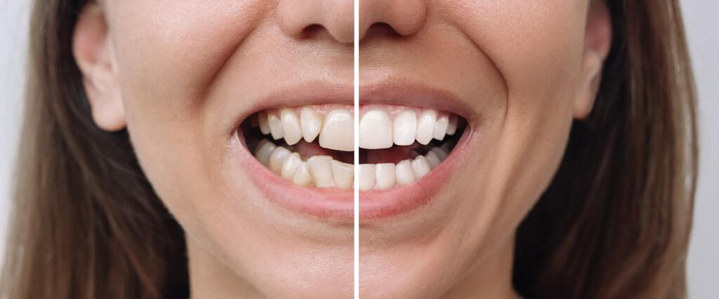 Cosmetic Dentistry: Creating a Smile You’ll Feel Confident Sharing